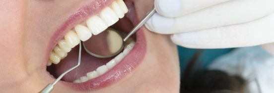 check-up-odontologico3